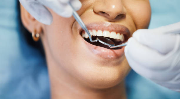 Best Broken or Cracked Tooth Emergency Dentist in Prices Fork, VA