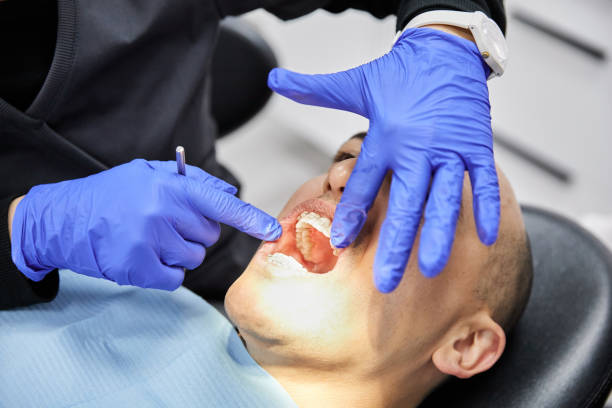 Best Emergency Dentist for Knocked-Out Tooth in Prices Fork, VA